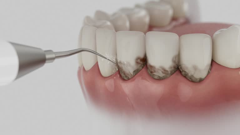 Reliable Wisdom Tooth Removal contractor in Clay County County, AL by Dentist Open Now